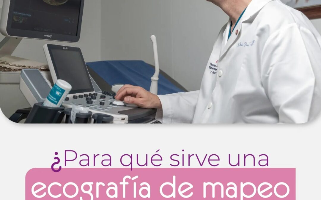 ¿Para qué sirve una ecografía de mapeo en el diagnóstico de la endometriosis?