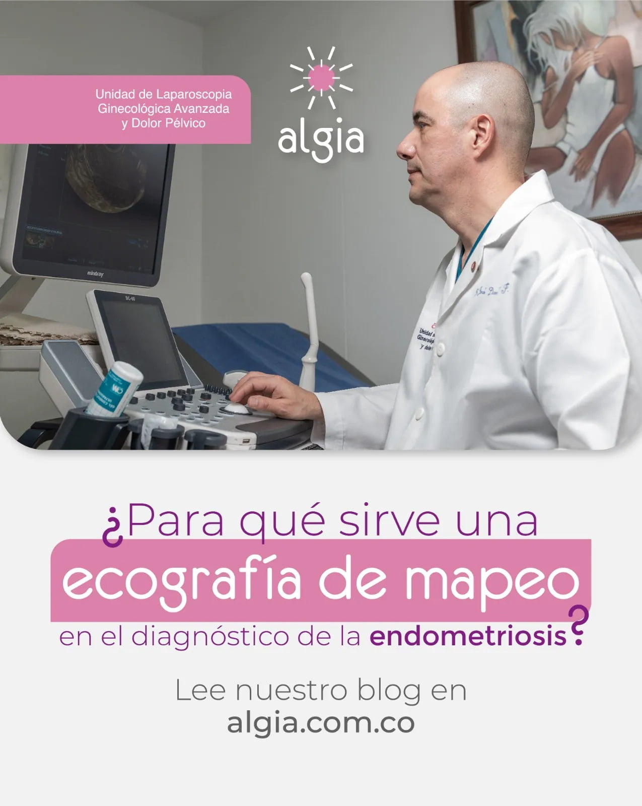 ¿Para qué sirve una ecografía de mapeo en el diagnóstico de la endometriosis?
