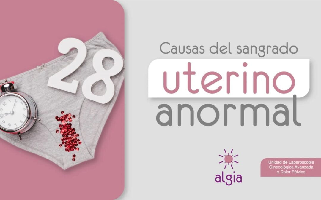 Causas del sangrado uterino anormal