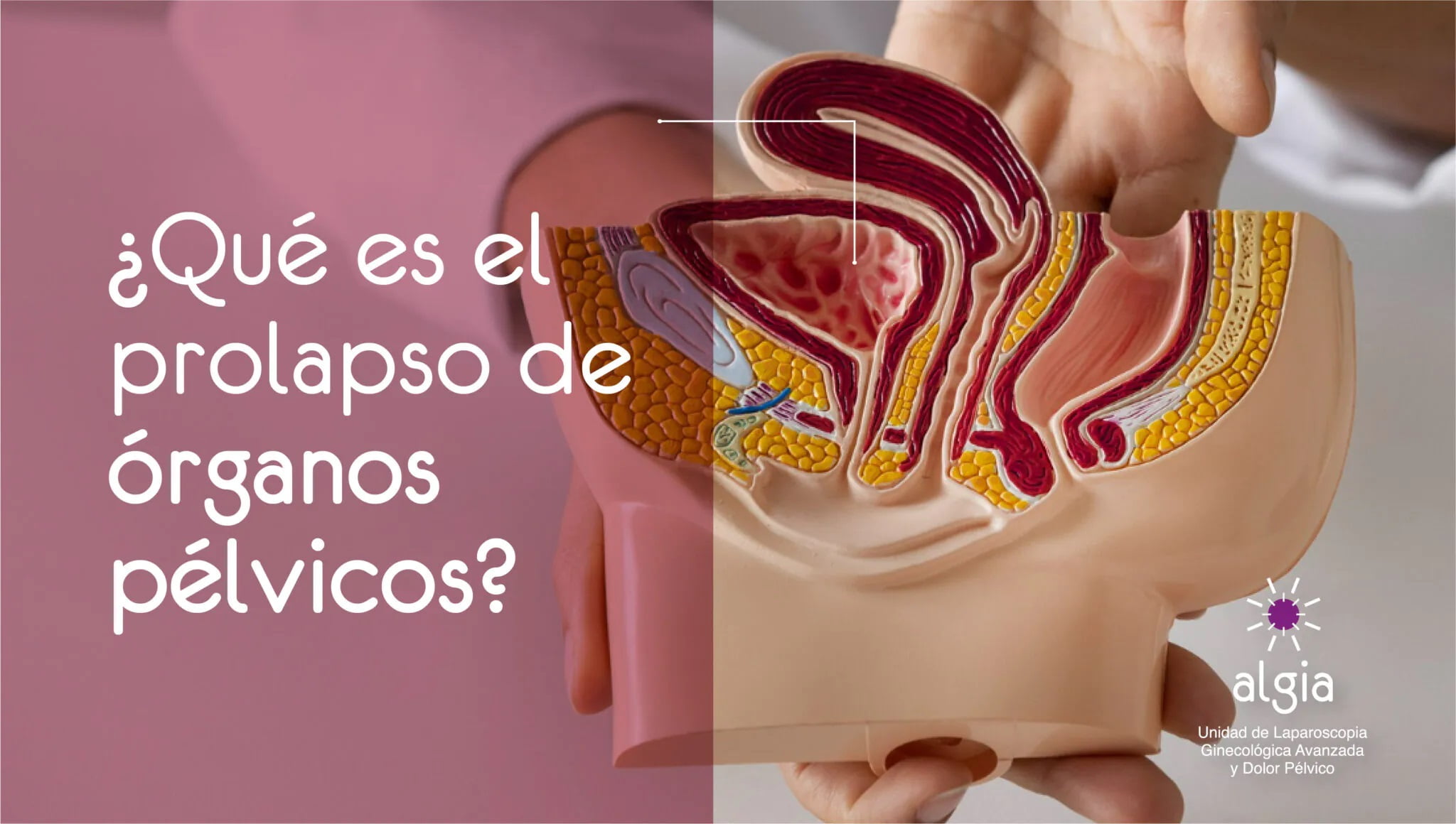 Que-es-el-prolapso-de-organos-pelvicos-2048x1160